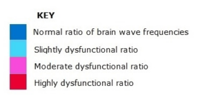 key-to-brainwave-scan